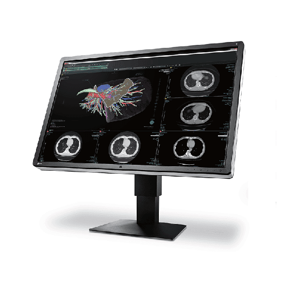 EIZO Eizo RX660 Colour Diagnostic LCD Monitor 30"" 3MP # 371945