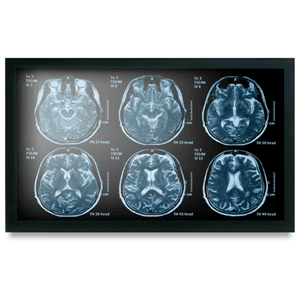 Onyx Onyx MEDDP-622HNN 21.5" Medical Display NX1121