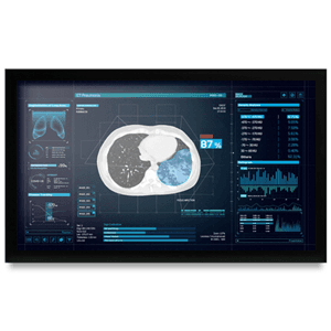 Onyx Onyx MEDDP-627HNN 27" Medical Display NX1149