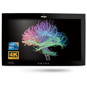 Onyx Onyx ACCEL-A3201 i7 32" 4K OR Station PCAP Touch NX5937
