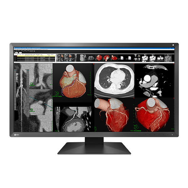Eizo MX317 Colour DICOM LCD Monitor 31"" 8.8MP # EIZO — view 2