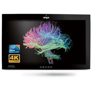 Onyx ACCEL-A3201 i7 32" 4K OR Station PCAP Touch Onyx — view 2